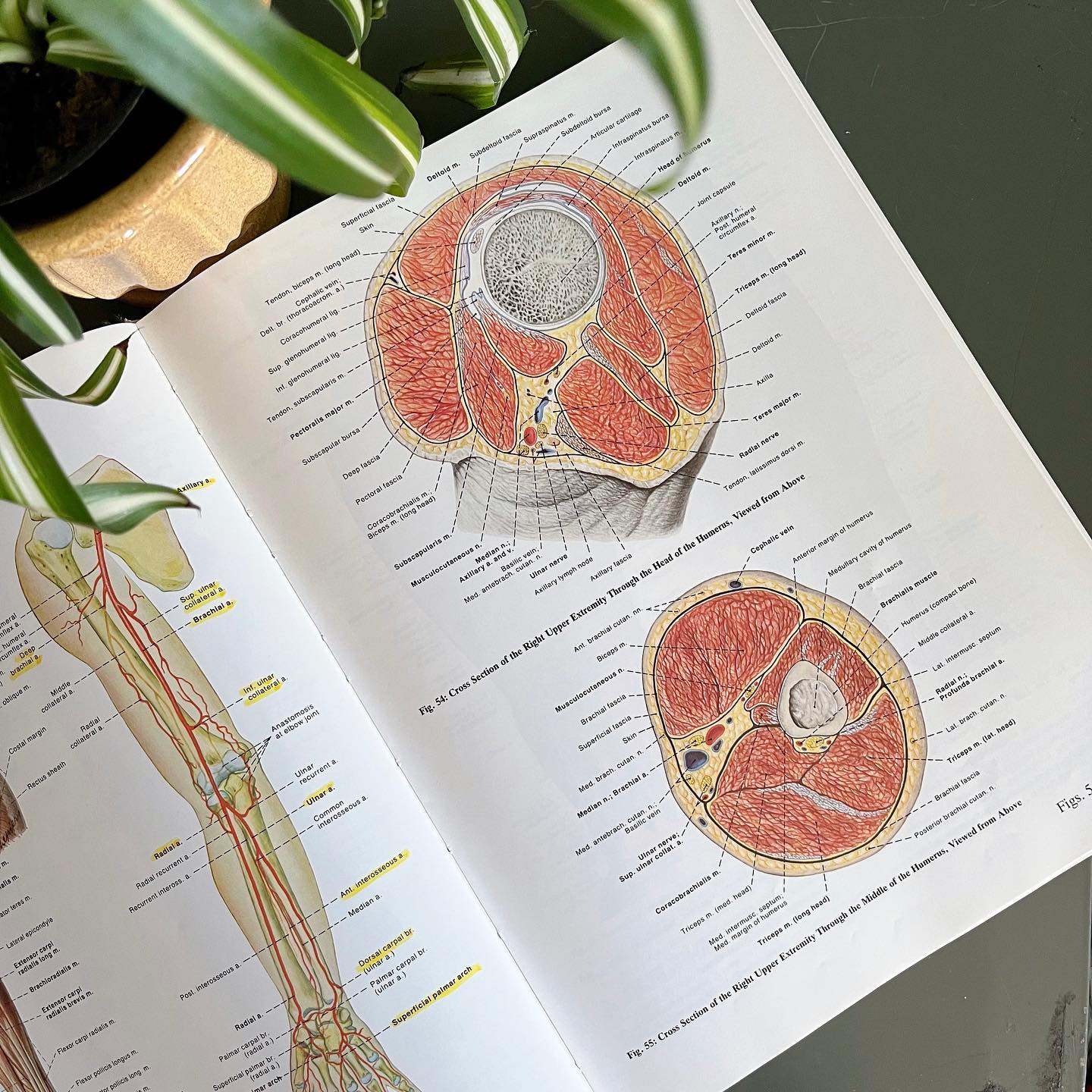 "Anatomy: A Regional Atlas of the Human Body" hardcover book (1984) - No Kill Vintage