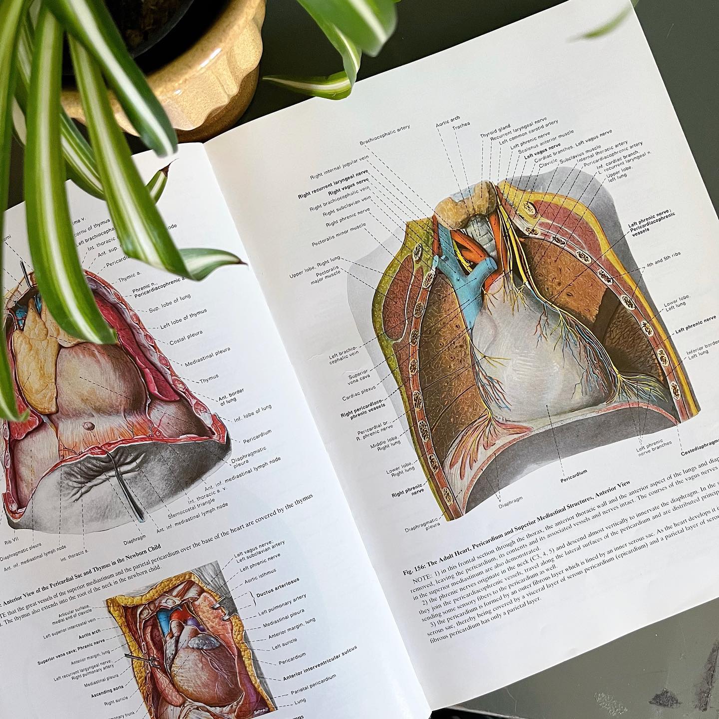 "Anatomy: A Regional Atlas of the Human Body" hardcover book (1984) - No Kill Vintage